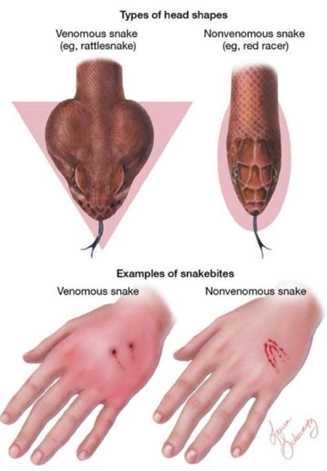 How To Know If A Snake Is Deadly Or Not | Others