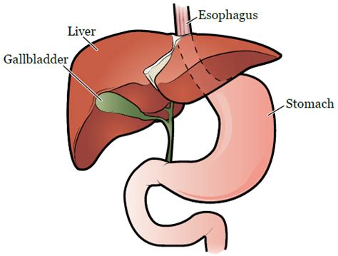 Gallbladder Removal And Colon Cancer Risk