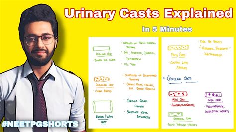 Urinary Casts - Types, Causes and Identification - YouTube