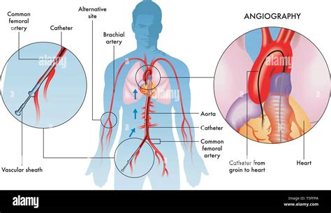 Diagram Of Male Groin Area / Pdf The Surgical Anatomy Of The Inguinal Lymphatics - As a result ...