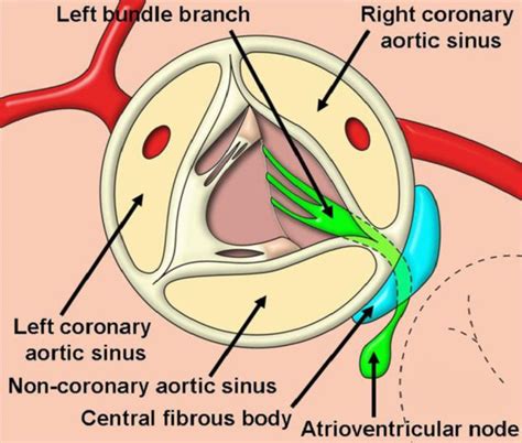 Aortic sinuses | Médecine