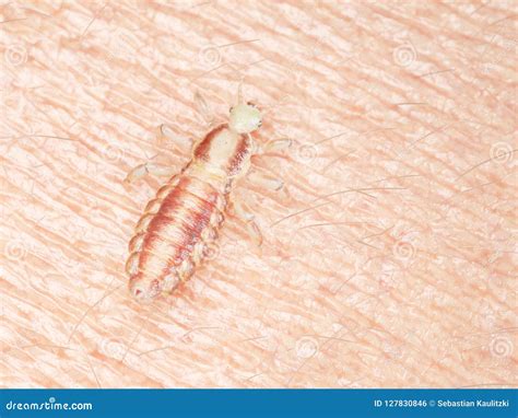 A head louse stock illustration. Illustration of biology - 127830846