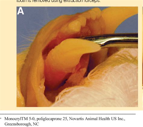 Figure 1 from Surgical Extraction of the Mandibular Canine Tooth in the ...