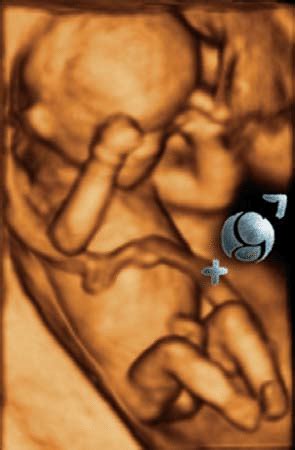 Three-dimensional (3D) ultrasound assessment of fetus in the first... | Download Scientific Diagram