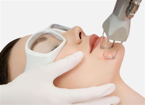 Best Laser Scar Removal: Toronto Face Scar Removal Treatment