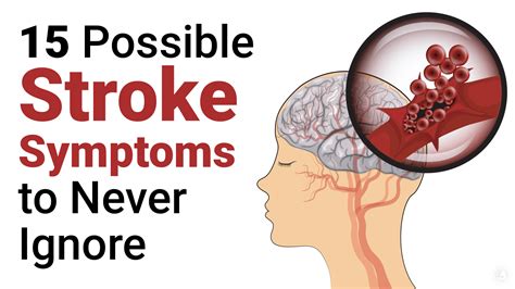 15 Stroke Symptoms That Doctors Ask You Not To Ignore
