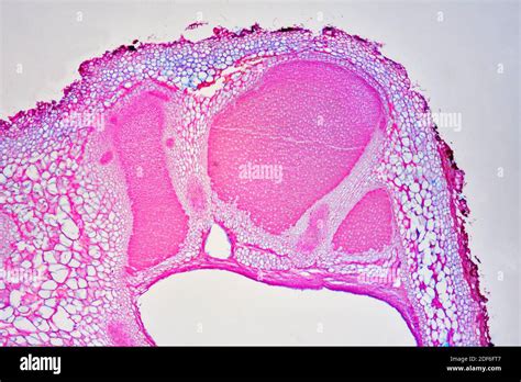 Rhizobium hi-res stock photography and images - Alamy