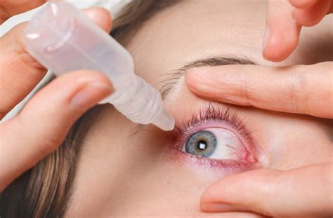 10 Causes & Treatments for Eye Redness | Niagara Falls, ON