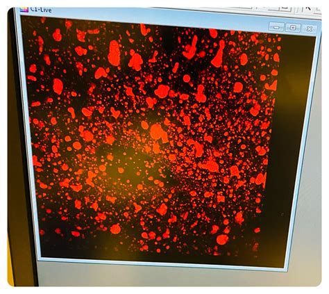 How to perform Nile red staining? | ResearchGate