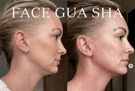 Gua Sha: The Ancient Chinese Beauty Secret for Youthful Skin and Total Well-being