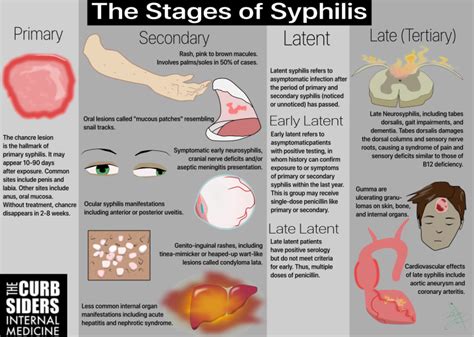 #127 STIs Syphilis, Gonorrhea and Chlamydia - The Curbsiders