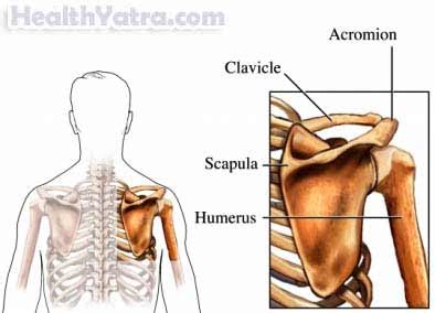 Floating Shoulder Definition, Causes, Symptoms, Complications and Cost Surgery Treatment ...