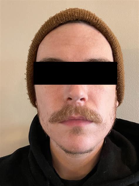 Been growing handlebars for a couple years. I’m hoping I can grow this ...