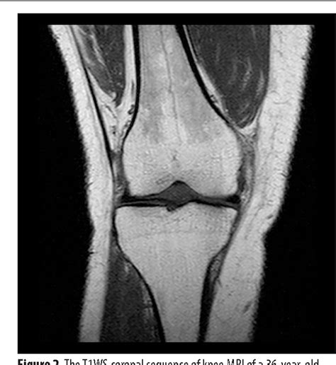 Figure 2 from MRI of Residual Red Bone Marrow in the Distal Femur of ...