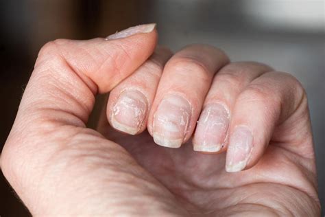 What to know before going faux: Press-on nails are convenient — but risky