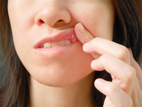 Bump on gums: Causes and how to treat them