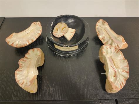 Anatomical Model of the Human Brain, 1950s at 1stDibs