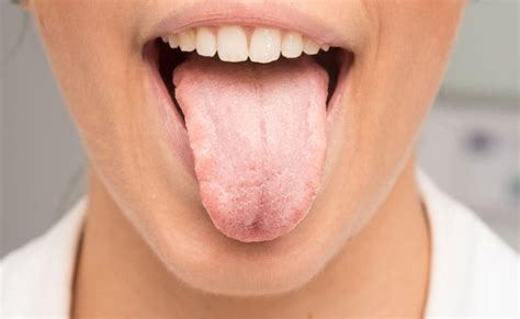 Dry tongue - Definition of Dry tongue