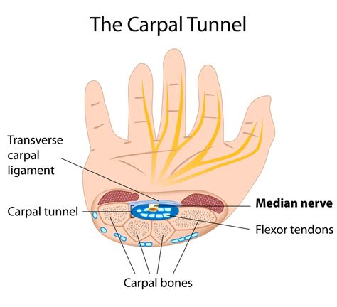 What is Carpal Tunnel Syndrome?doctor_step