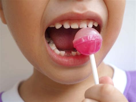 Treating Tooth Decay in Children | Penn Dental Family Practice