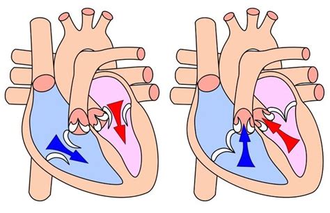 Systole: Definition, Pressures, Flow, Phases and Ventricular Diastole - Scope Heal