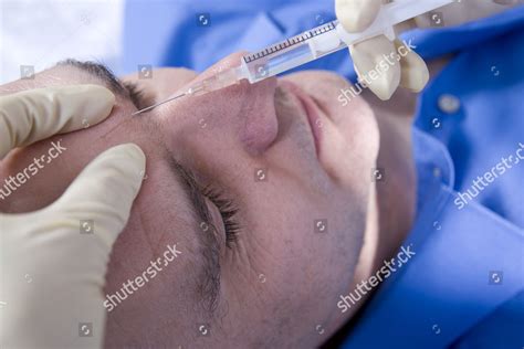 Model Released Patient Having Botox Injection Editorial Stock Photo ...