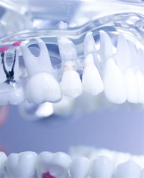 Dental teeth mouth model stock photo. Image of equipment - 101655914