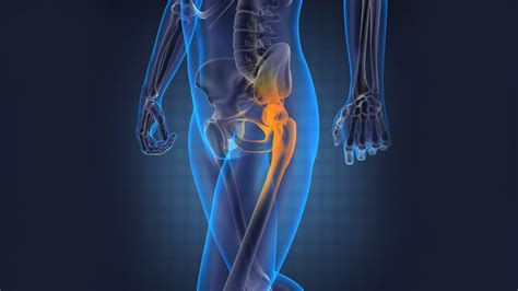 The Recovery Phase from A Hip Replacement Surgery