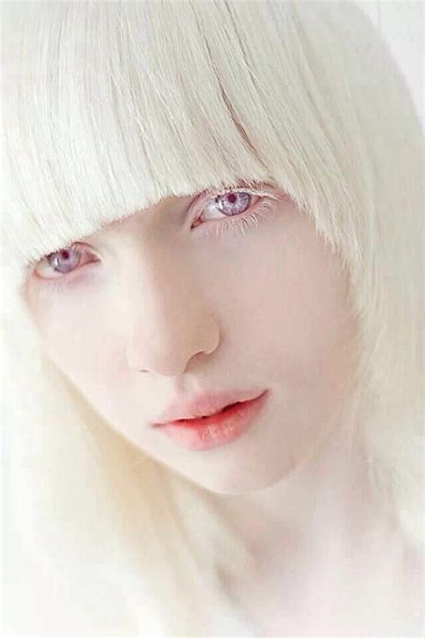 From Russia's 16-year-old suffering from albinism model Nas ... | Augen ...