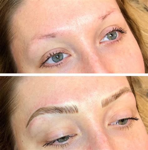 Thinning Eyebrows Common Causes | Best Microblading in Frisco