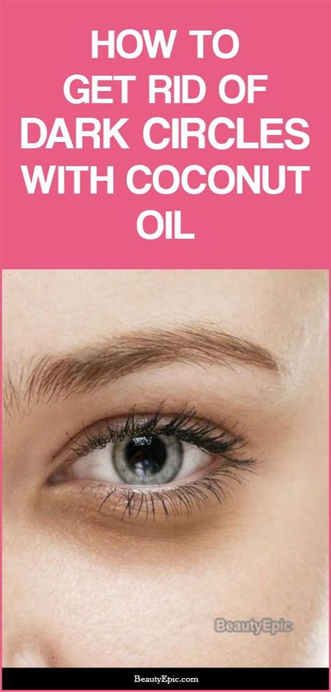 How to Use Coconut Oil for Dark Circles Under Eyes? | Dark eyes circles ...