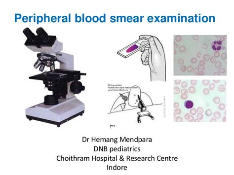 05 peripheral blood smear examination