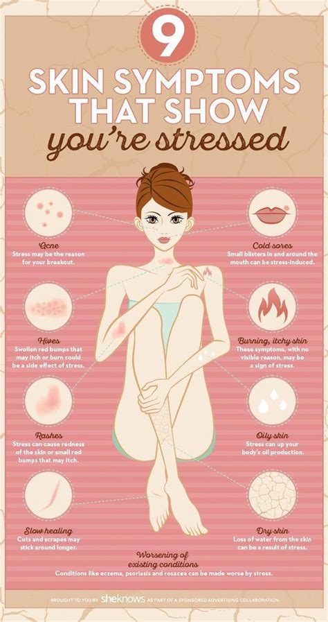 These skin symptoms might tell you when it's time to relax. Skin symptoms that show you're ...