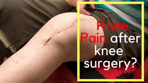 pain after knee replacement - YouTube