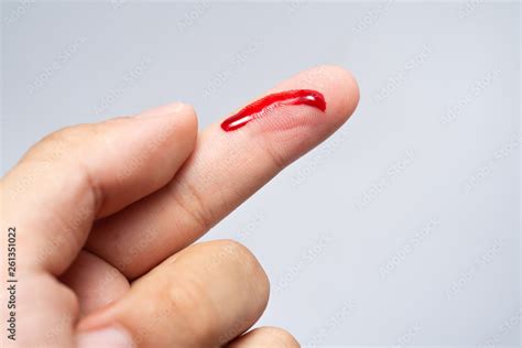 Bleeding blood from the cut finger wound. Injured finger with bleeding ...