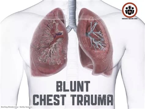 Shock and Hypoxia in Blunt Chest Trauma | CritCases 13 | EM Cases