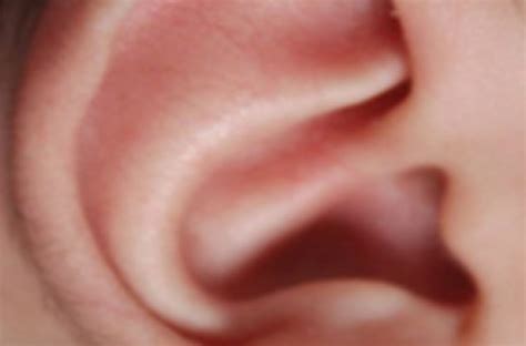 Cauliflower Ear(Deformed Ear)