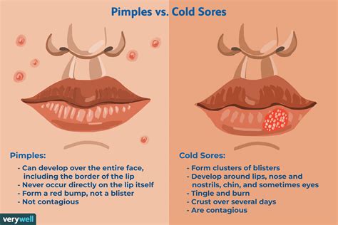 Cold Sore vs. Pimple: How to Tell the Difference