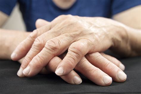 What You Need to Know About Rheumatoid Arthritis Symptoms and Treatment ...