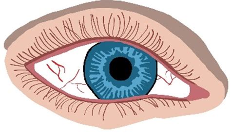 Strabismus vs Pseudo-Strabismus