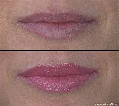 Quick Fix for Lip Wrinkles