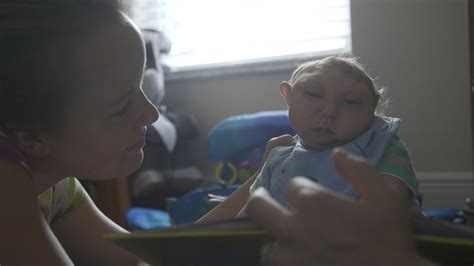 Florida 'Miracle Baby' Born Without Most of His Brain Beating the Odds - ABC News