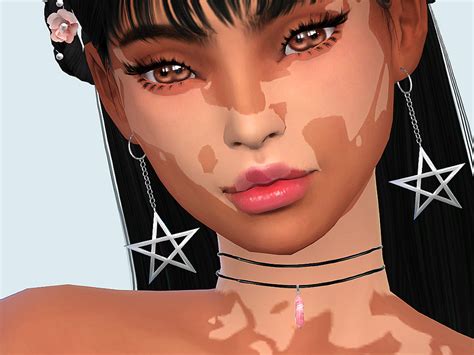 Saruins Skin Detail Vitiligo Set No 2 The Sims 4 Skin Sims 4 Body | Images and Photos finder