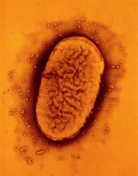 Tem Of Bordetella Pertussis Bacterium Photograph by A. Dowsett, Public ...