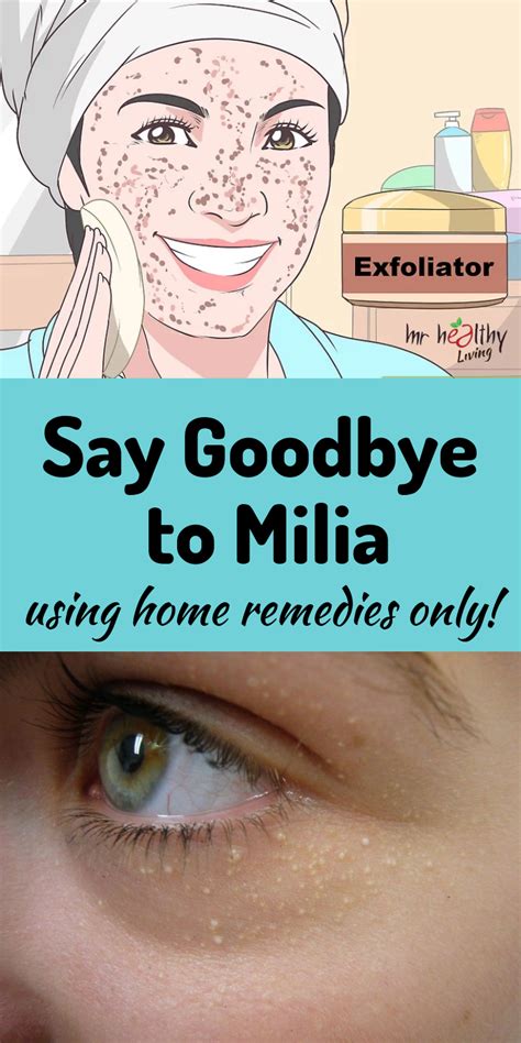 How To Get Rid Of Milia: A Guide To Removal – EadvVienna2020.org