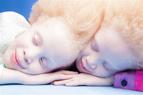 Lara And Mara The Albino Twin Models From Brazil Are The Talk Of The ...