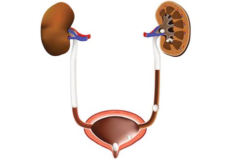 Vesicoureteral Reflux - Dr. Heidi Stephany