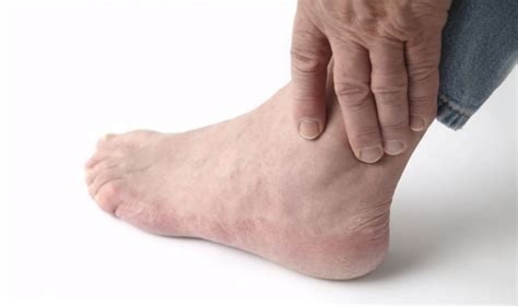 Top Tips to Combat Ankle Stiffness