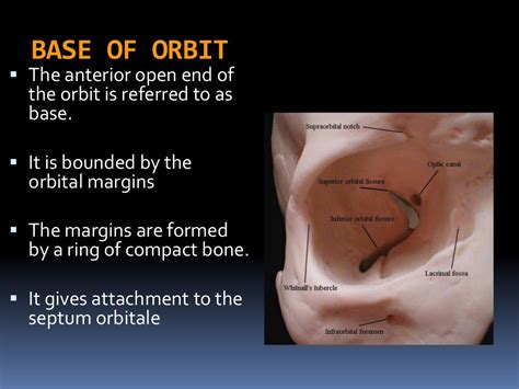 Bony orbit and its contents