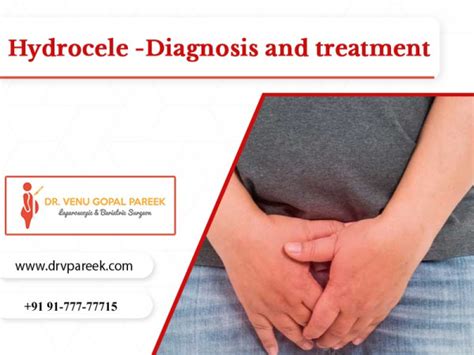 Hydrocele -Diagnosis And Treatment